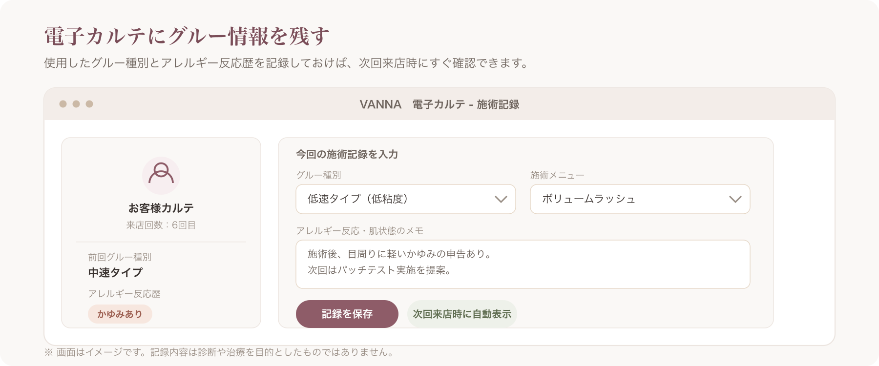 電子カルテ画面でグルー種別とアレルギー反応歴を記録している様子のイメージ
