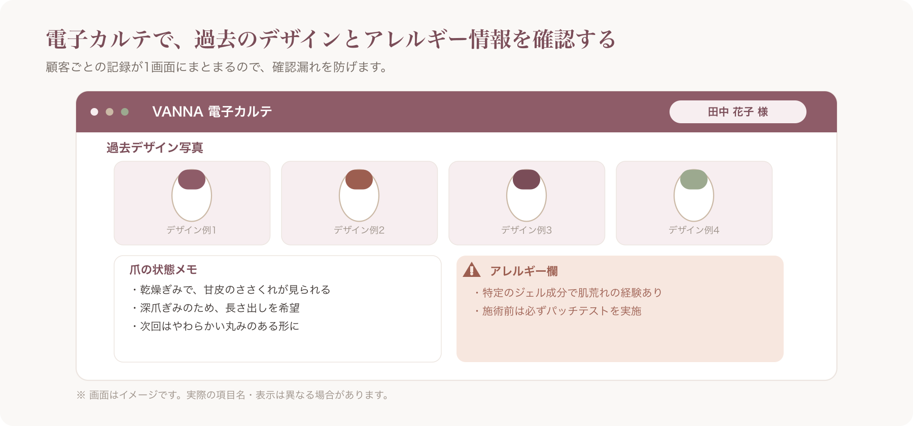 電子カルテ画面で顧客の過去デザイン写真と爪の状態メモ、アレルギー欄を確認しているイメージ